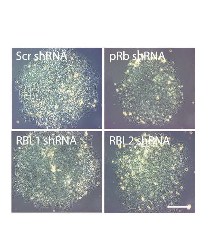 Open access visualization of Microscopy, hPSCs, RBs, Knockdown, Morphology