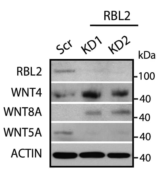 Open access visualization of Gel, RBL2-KD, WNT4 Expression, WNT8A Expression, Neuroectoderm Differentiation