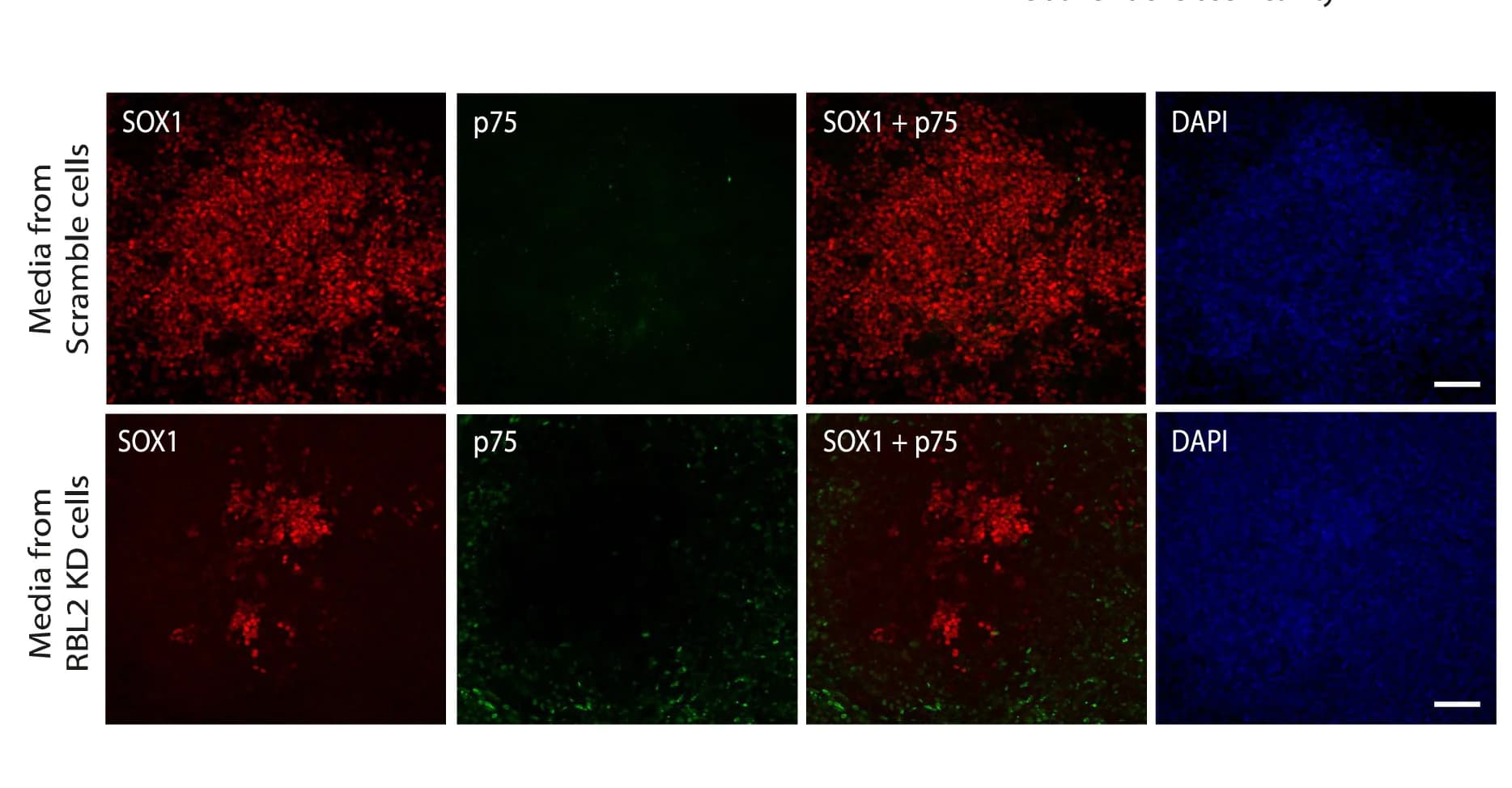 Open access visualization of Microscopy, RBL2, Cell Fate Decisions, Neuroepithelium, Neural Crest Formation