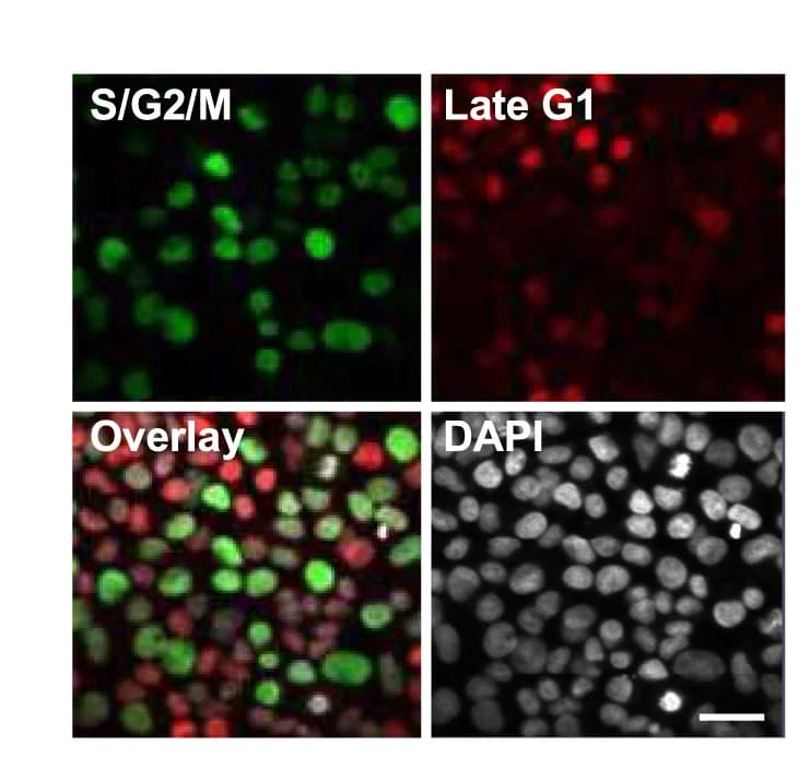 Open access visualization of Microscopy, Fluorescence Microscopy, FUCCI-expressing cells