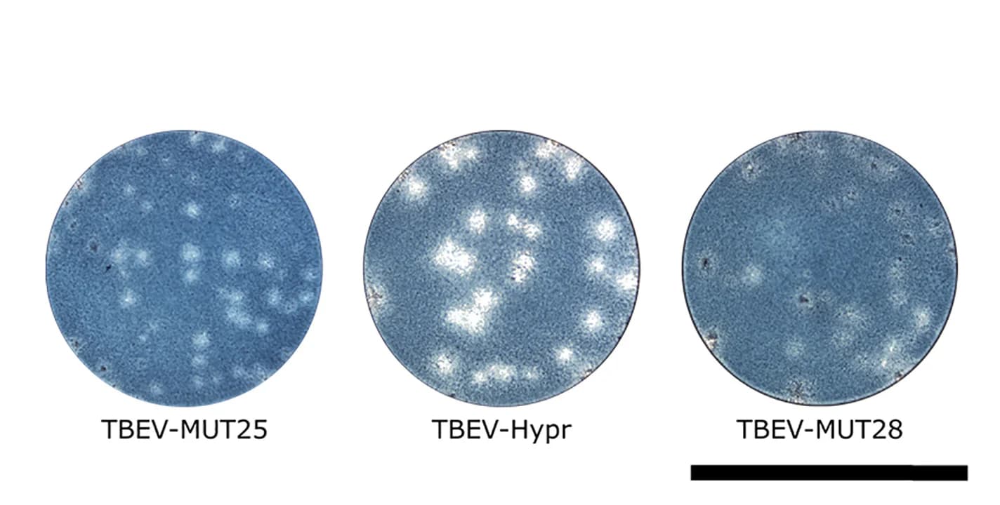 Open access visualization of Microscopy, Plaque morphology, Virus