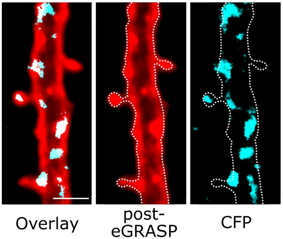 Open access visualization of Microscopy, Deconvolved Confocal Images, MC-PVI Contacts, Spines, Dendritic Shafts