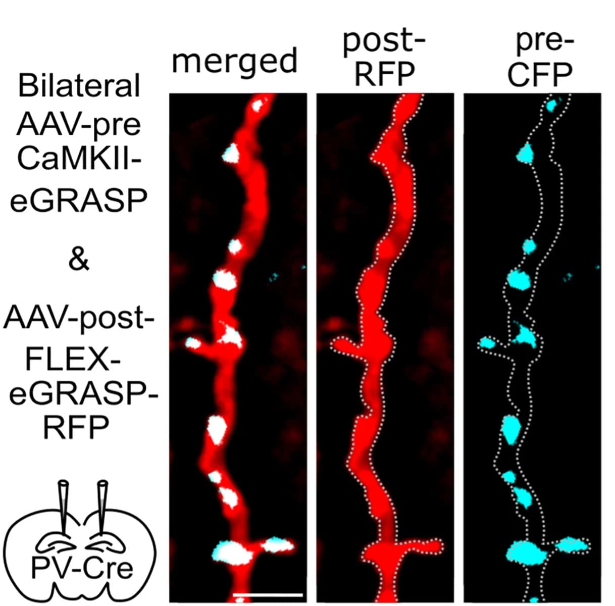 Open access visualization of Microscopy, Methodology, Confocal Images, Dendritic PVI Segment, eGRASP Components