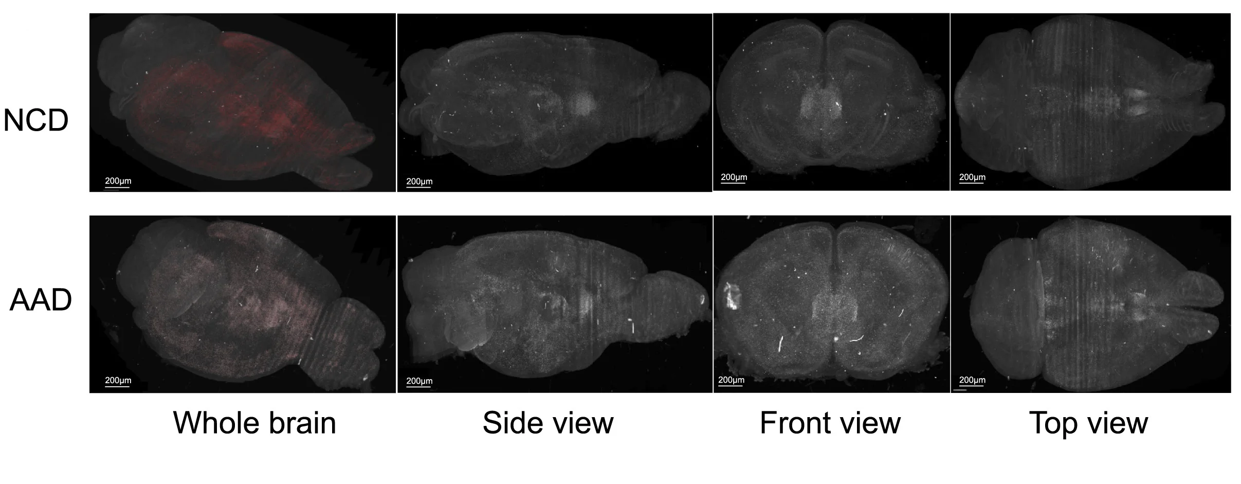 Open access visualization of Microscopy, cFos, Brain Imaging, AAD, NCD
