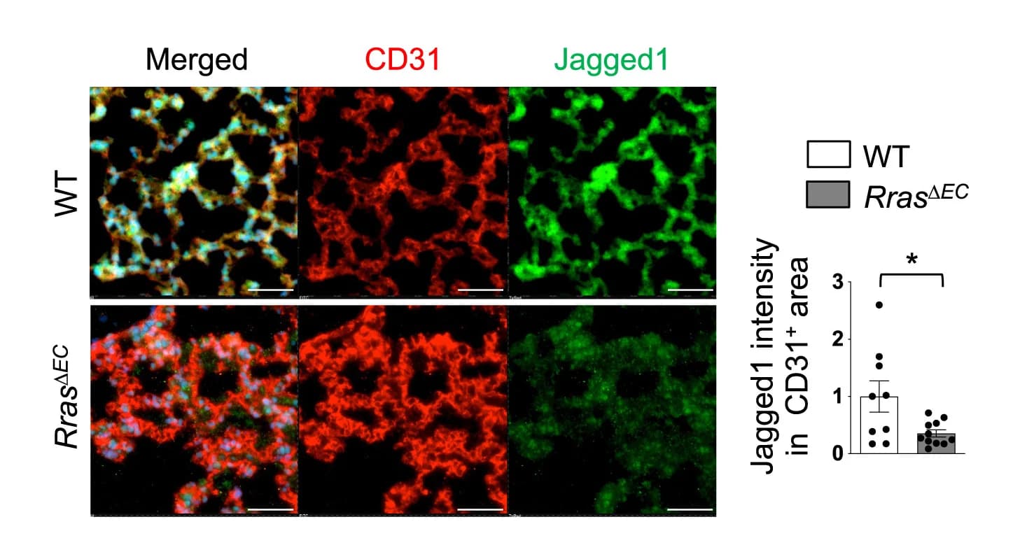 Open access visualization of Microscopy, Bar Plot, Error Bars, Jagged1 Expression, Lung Capillary ECs