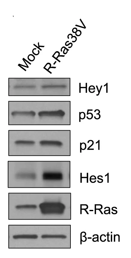 Open access visualization of Gel, Western Blot, EC Lysates, Cell Lysates, R-Ras38V