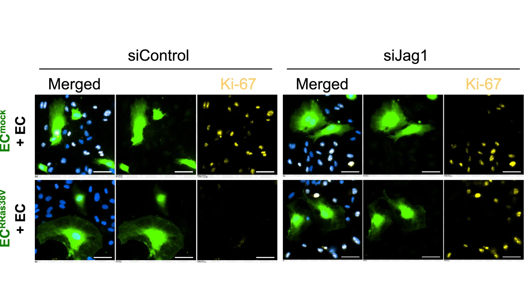 Open access visualization of Microscopy, Ki-67 Staining, Proliferating ECs, Coculture System, siRNA