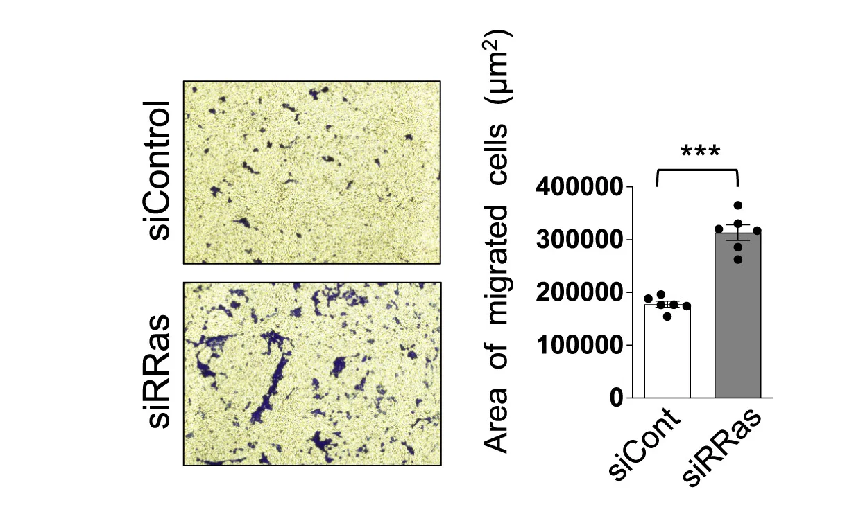 Open access visualization of Bar Plot, Error Bars, Microscopy, Transwell Migration Assay, ECs