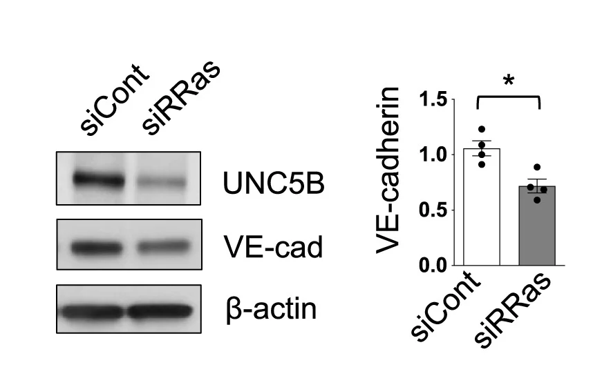 Open access visualization of Bar Plot, Error Bars, Gel, Western Blot, Jagged1 Silencing