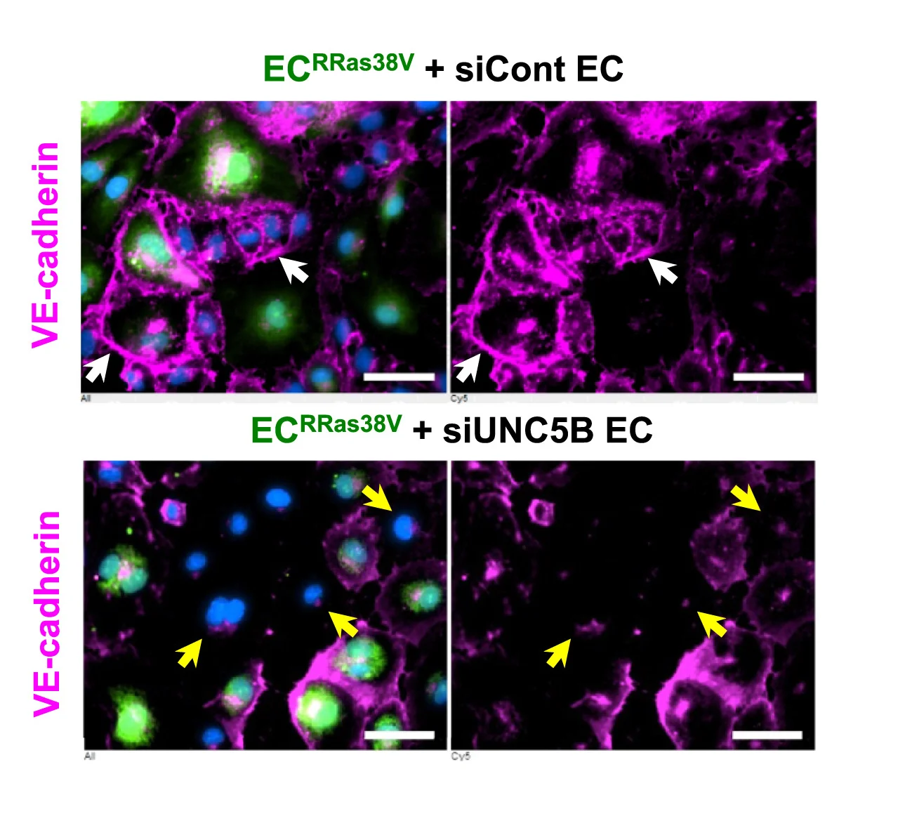Open access visualization of Microscopy, Cell Coculture, ECRRas38V, UNC5b Silencing, ECs