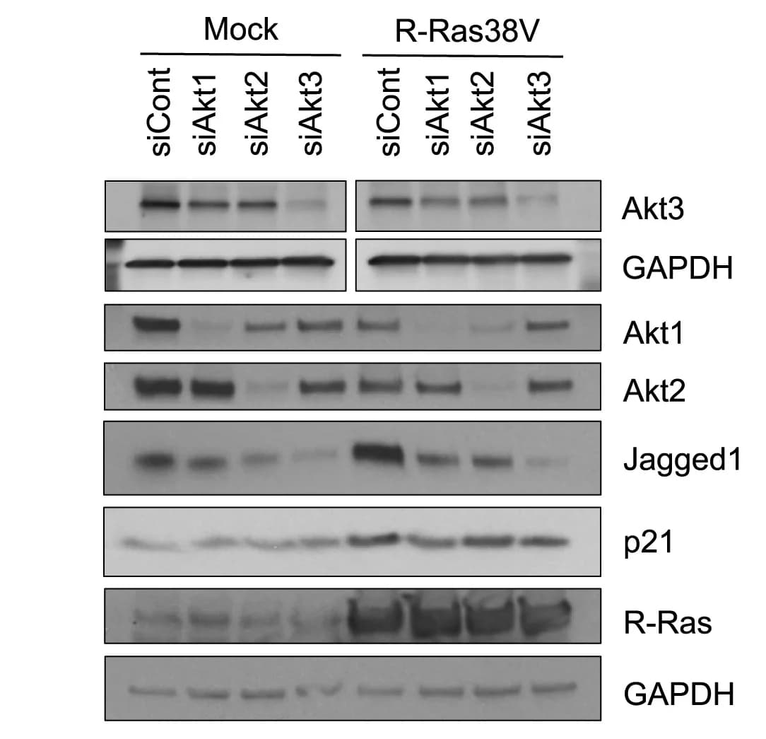 Open access visualization of Gel, Akt Isoform, Gene Silencing, Mock-Transduced ECs, R-Ras38V-Transduced ECs