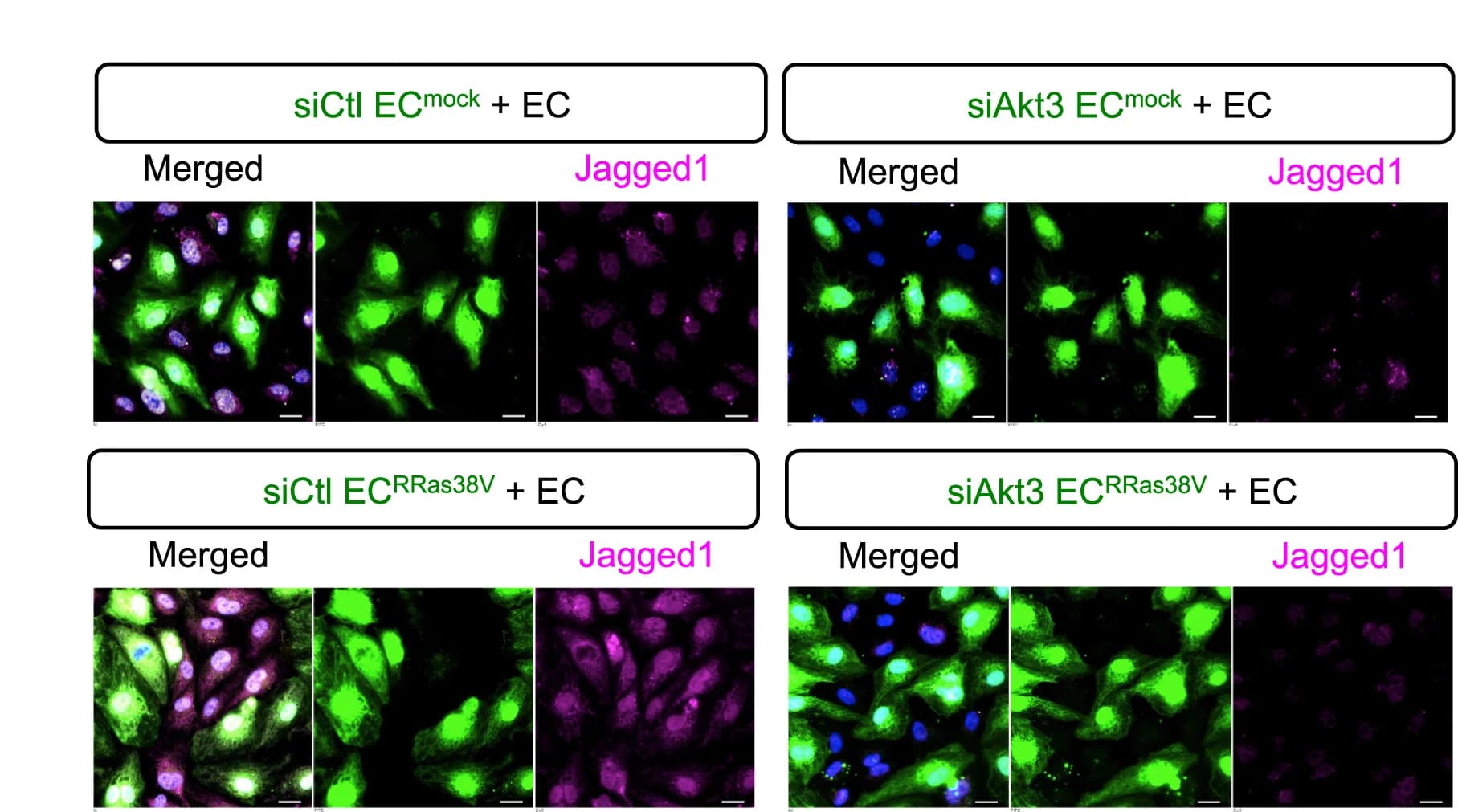 Open access visualization of Microscopy, Akt3 Isoform, Gene Silencing, Mock-Transduced ECs, R-Ras38V-Transduced ECs
