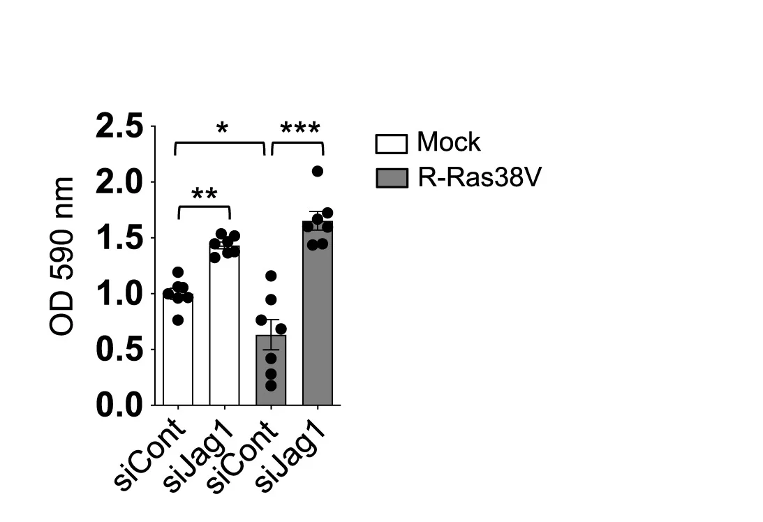 Open access visualization of Bar Plot, Error Bars, Jagged1, R-Ras38V, ECs