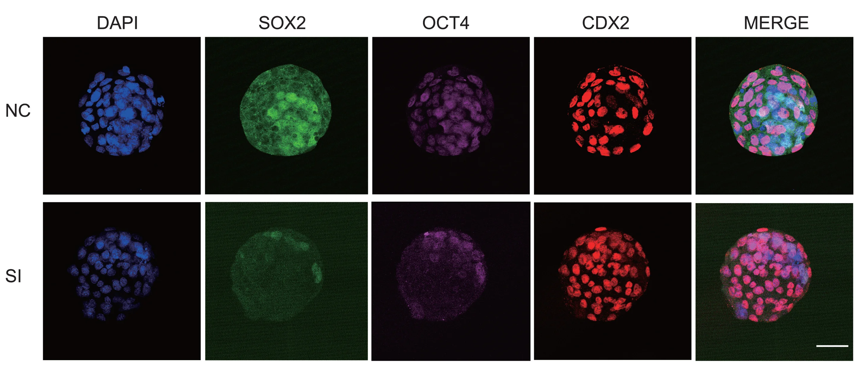 Open access visualization of Microscopy, Immunofluorescence, Blastocysts, SOX2, OCT4