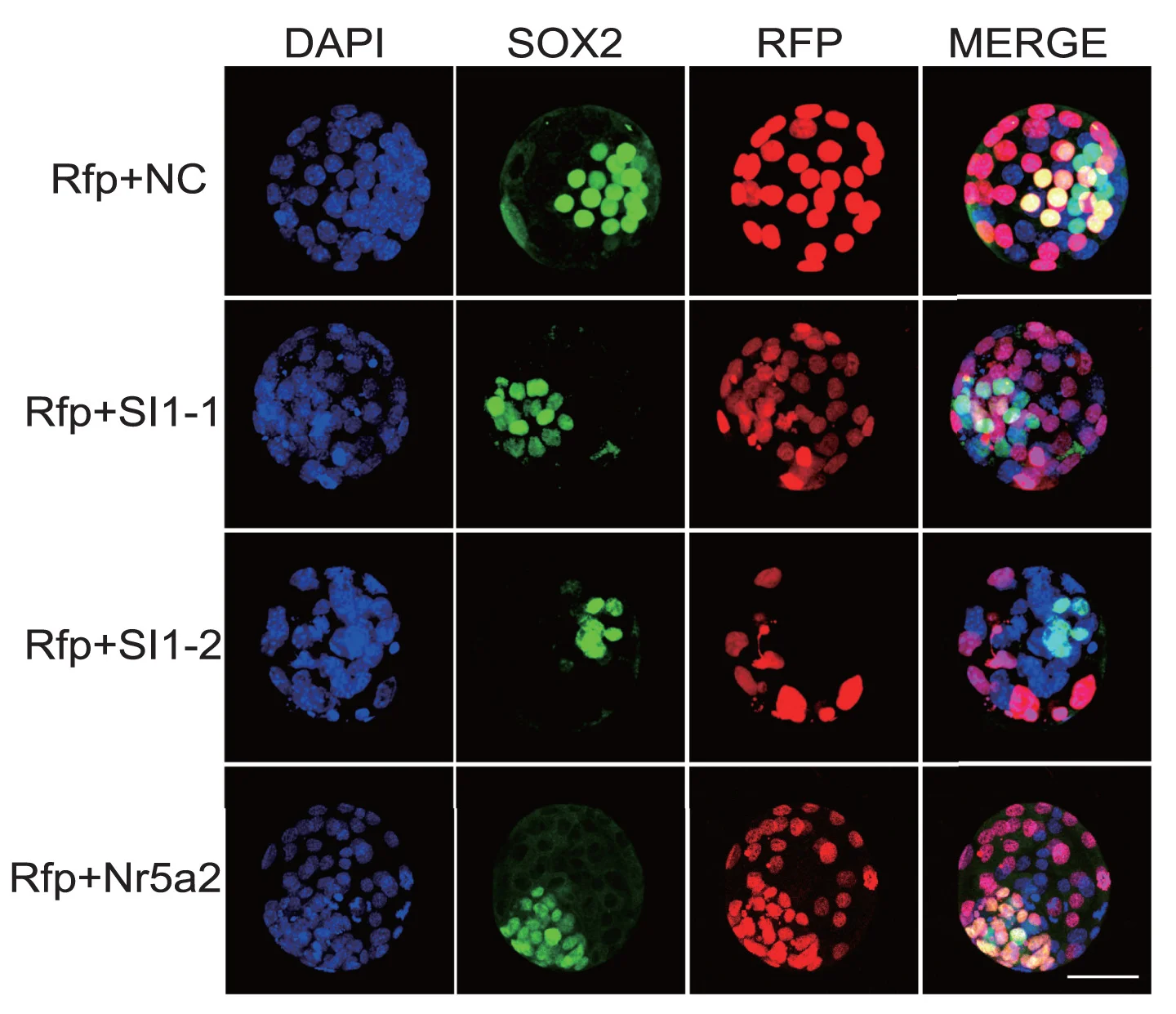 Open access visualization of Microscopy, Fluorescent Staining, Blastocysts, SOX2, RFP