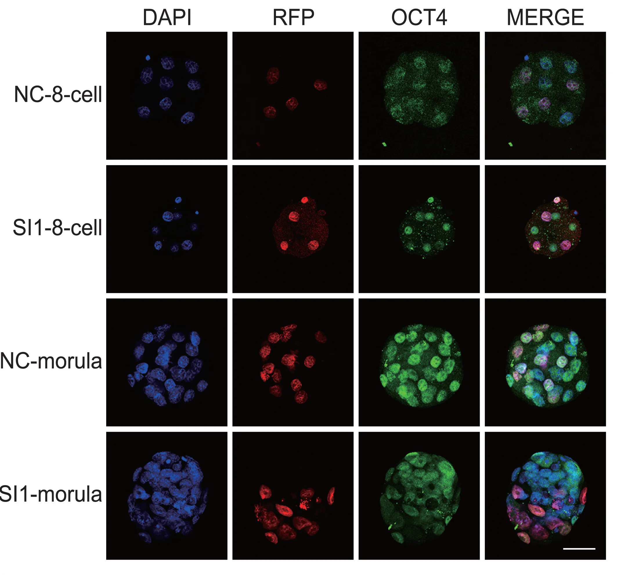 Open access visualization of Microscopy, OCT4, Immunofluorescence, 8-Cell Embryos, Morula Embryos