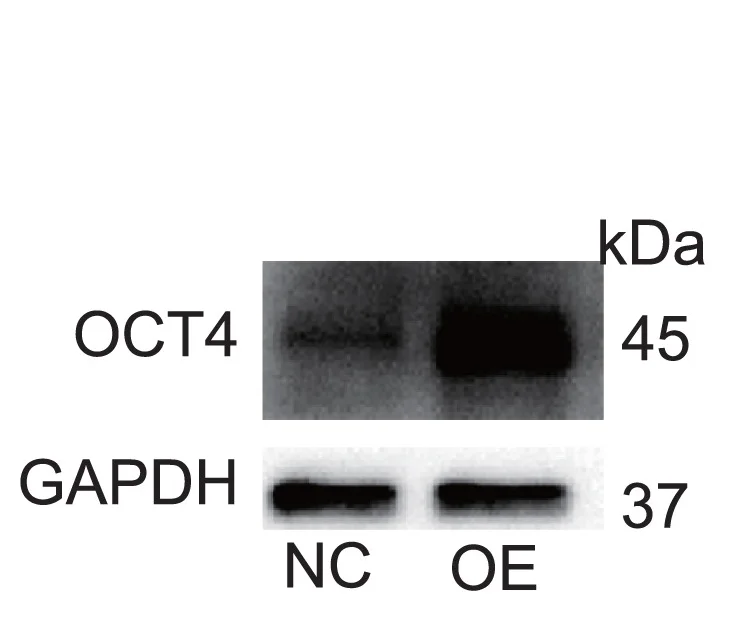 Open access visualization of Gel, Western Blot, OCT4, Overexpression