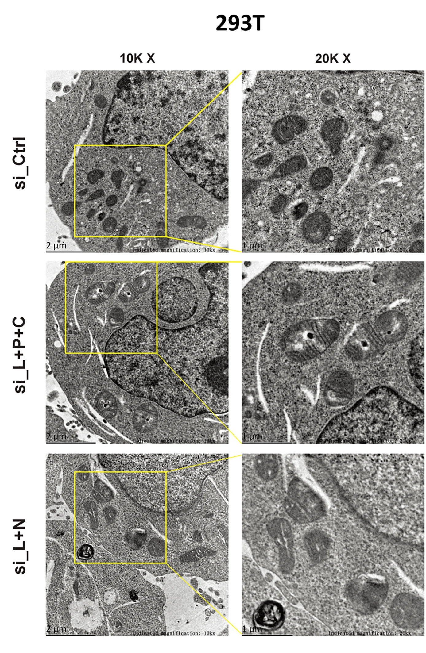 Open access visualization of Microscopy, Mitochondria Ultrastructure, Electron Microscopy, EM Images, Puncta
