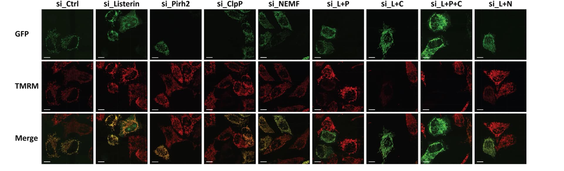 Open access visualization of Microscopy, Confocal Images, Mitochondria, HeLa Cells, siRNAs