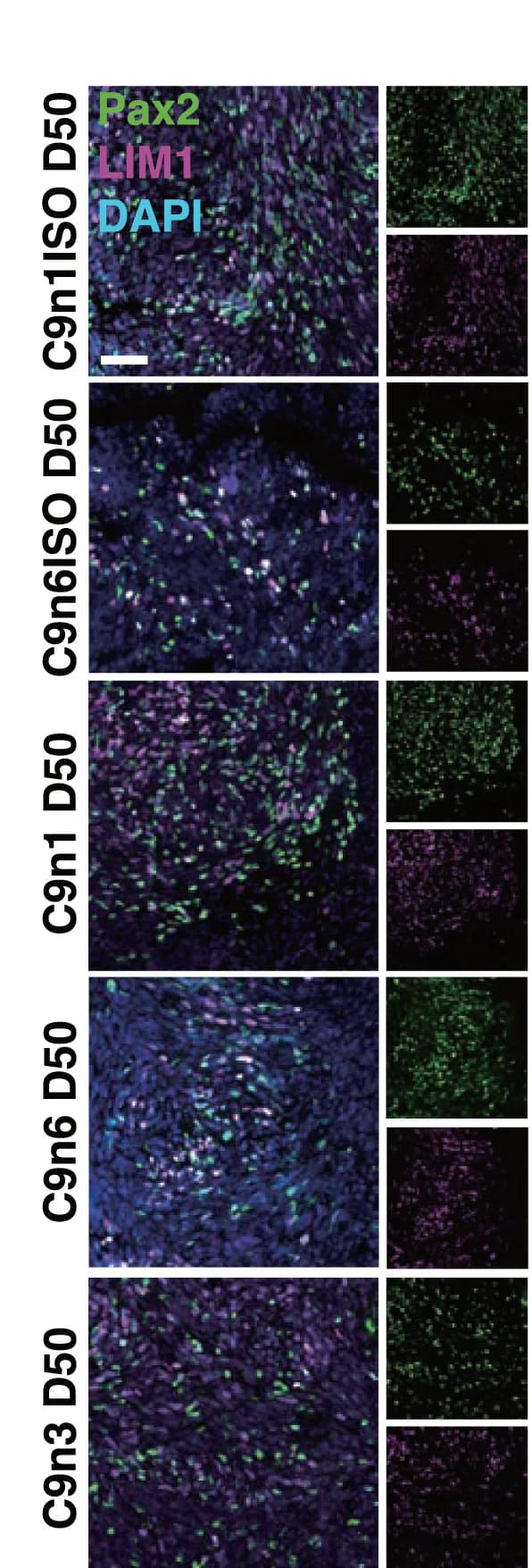 Open access visualization of Microscopy, Pax2+ Interneurons, LIM1+ Interneurons, Spinal Cord, C9n1/ISO