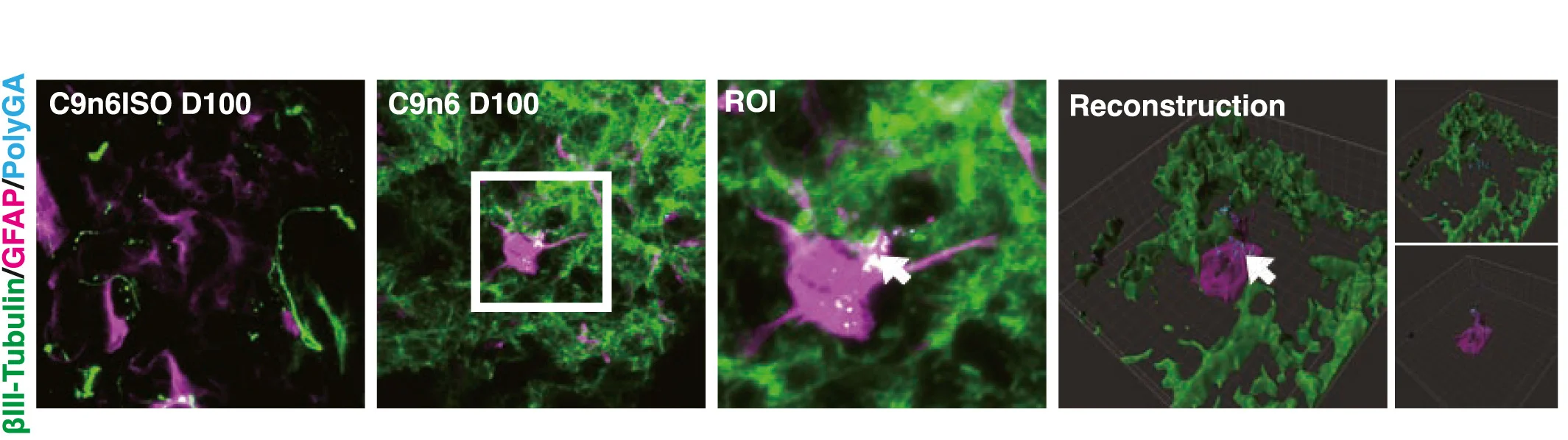 Open access visualization of Microscopy, 3D Plot, Immunofluorescence, 3D Reconstruction, PolyGA Aggregates
