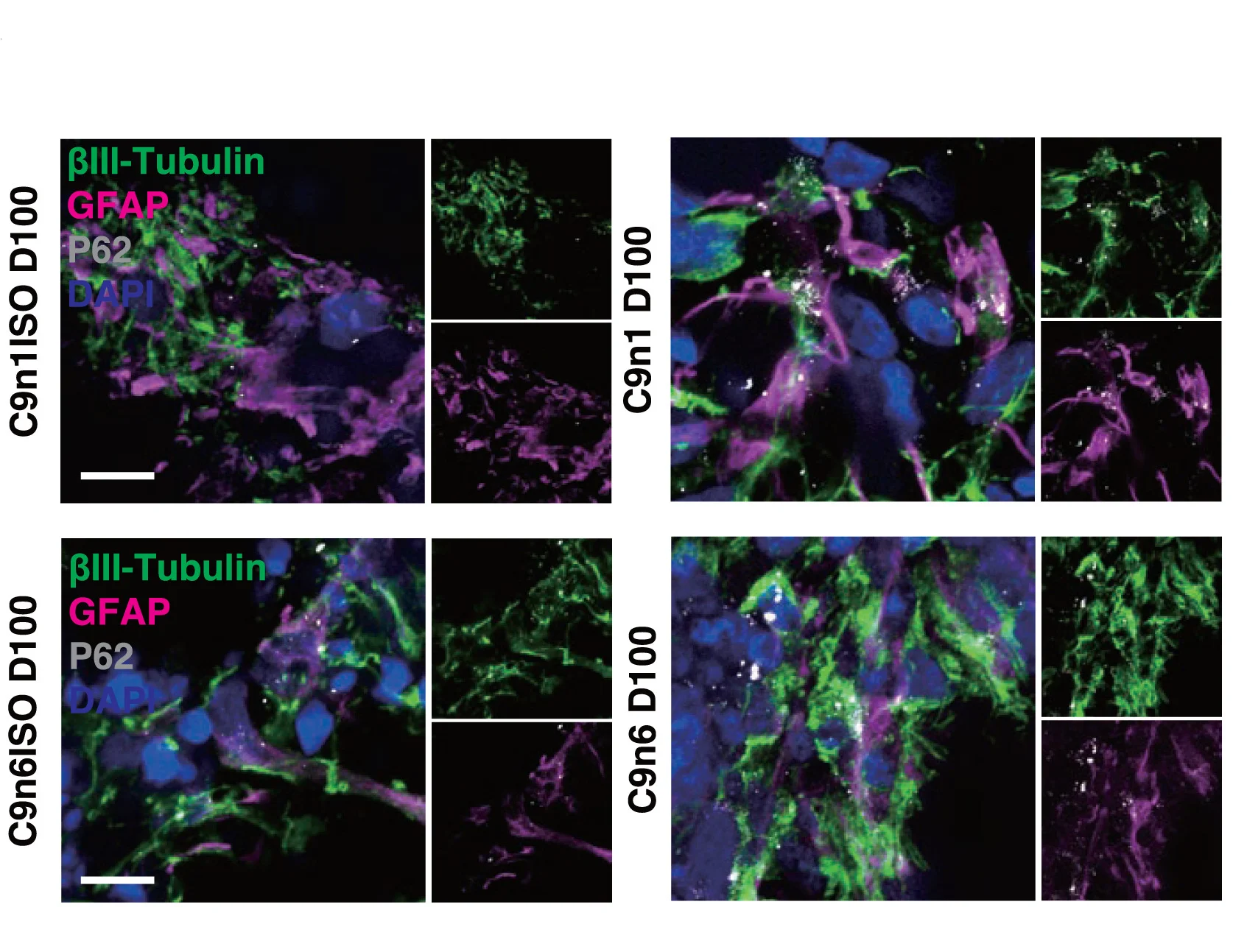 Open access visualization of Microscopy, P62 Puncta, Astrocytes, Neurons, GFAP