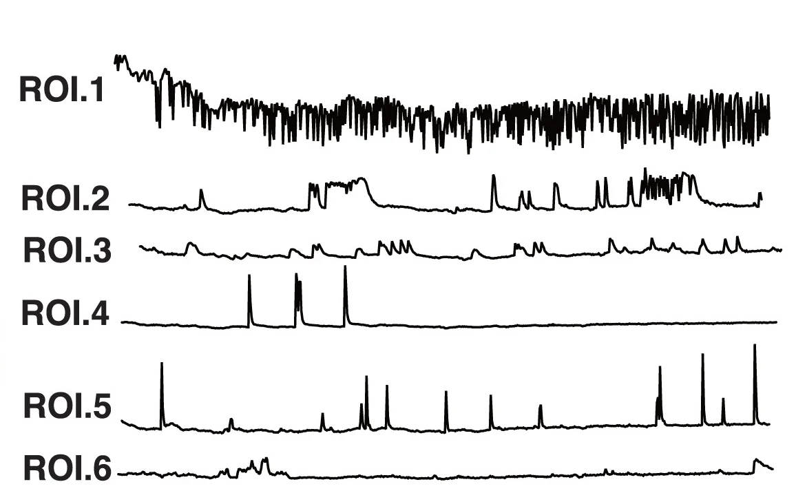 Open access visualization of Line Plot, Line Chart, Calcium Imaging, Region of Interest, Fluorescence