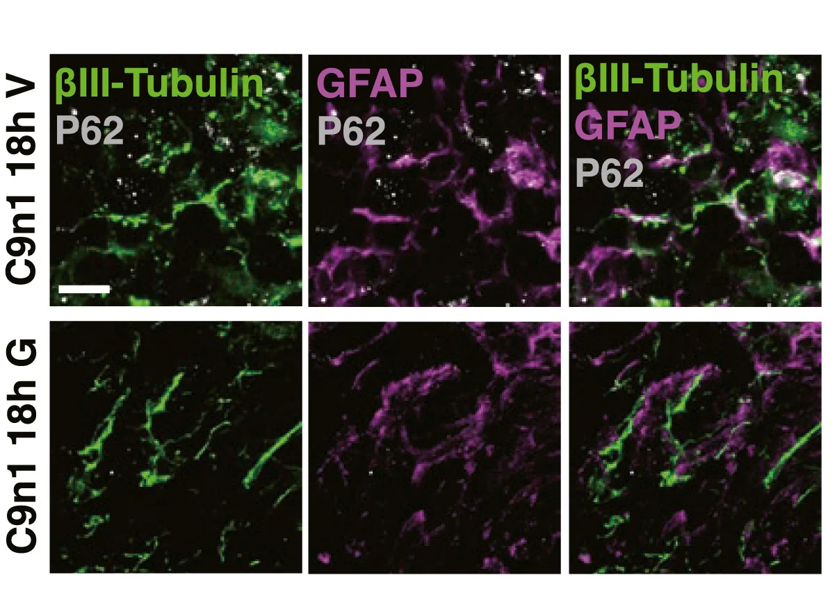 Open access visualization of Microscopy, P62, GFAP+Astrocytes, III-Tubulin+Neurons, Cryosections