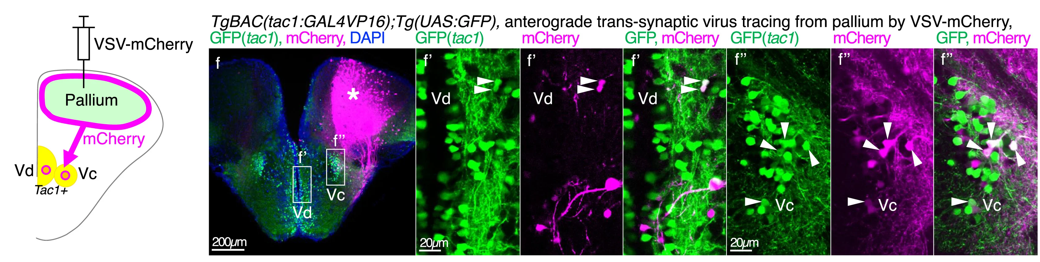 Open access visualization of Microscopy, Illustration, Coronal Section, VSV-mCherry Injection, Pallium