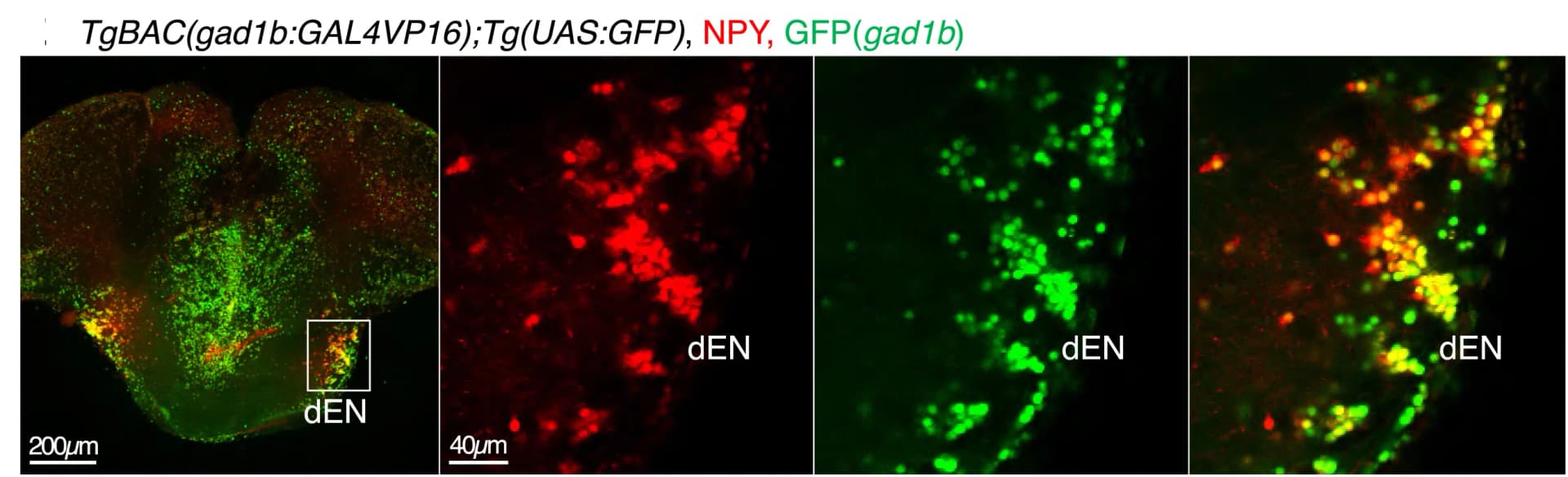 Open access visualization of Microscopy, Immunohistochemistry, Neurons, Fish, MaxIP