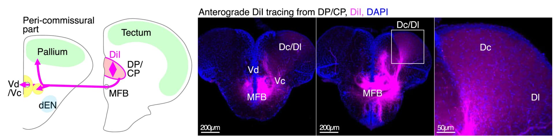 Open access visualization of Microscopy, Workflow, DiI Tracing, DP/CP, Projection Fibers