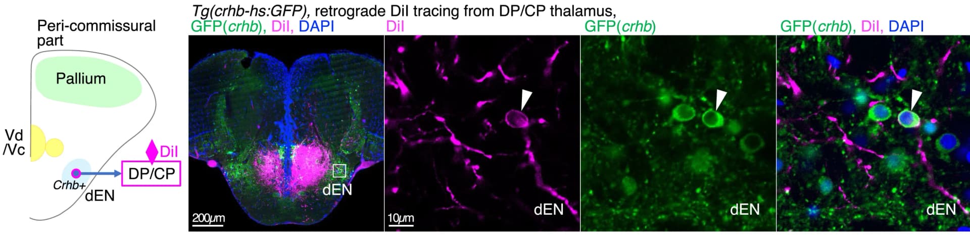 Open access visualization of Microscopy, Illustration, DiI Tracing, DP/CP, Tg(crhb-hs:GFP) Fish