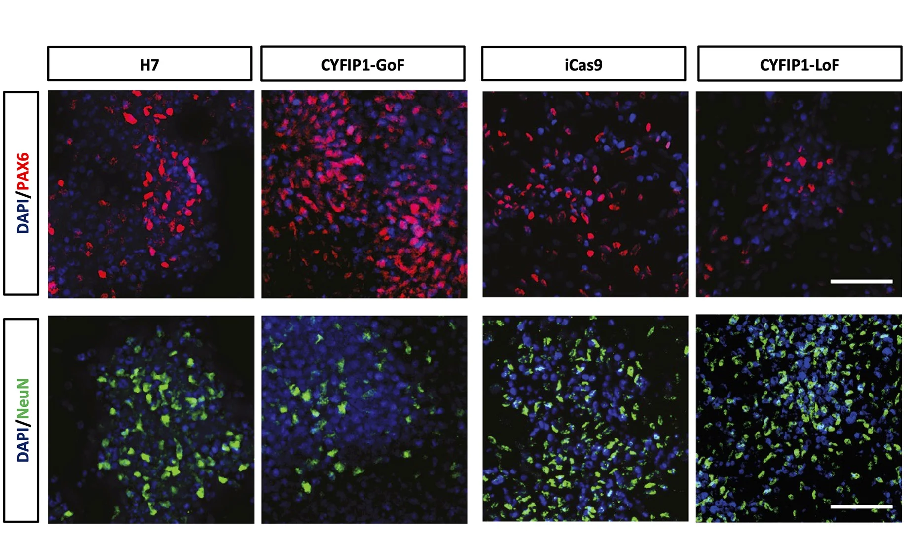 Open access visualization of Microscopy, Immunostaining, PAX6, NeuN, CYFIP1-GoF