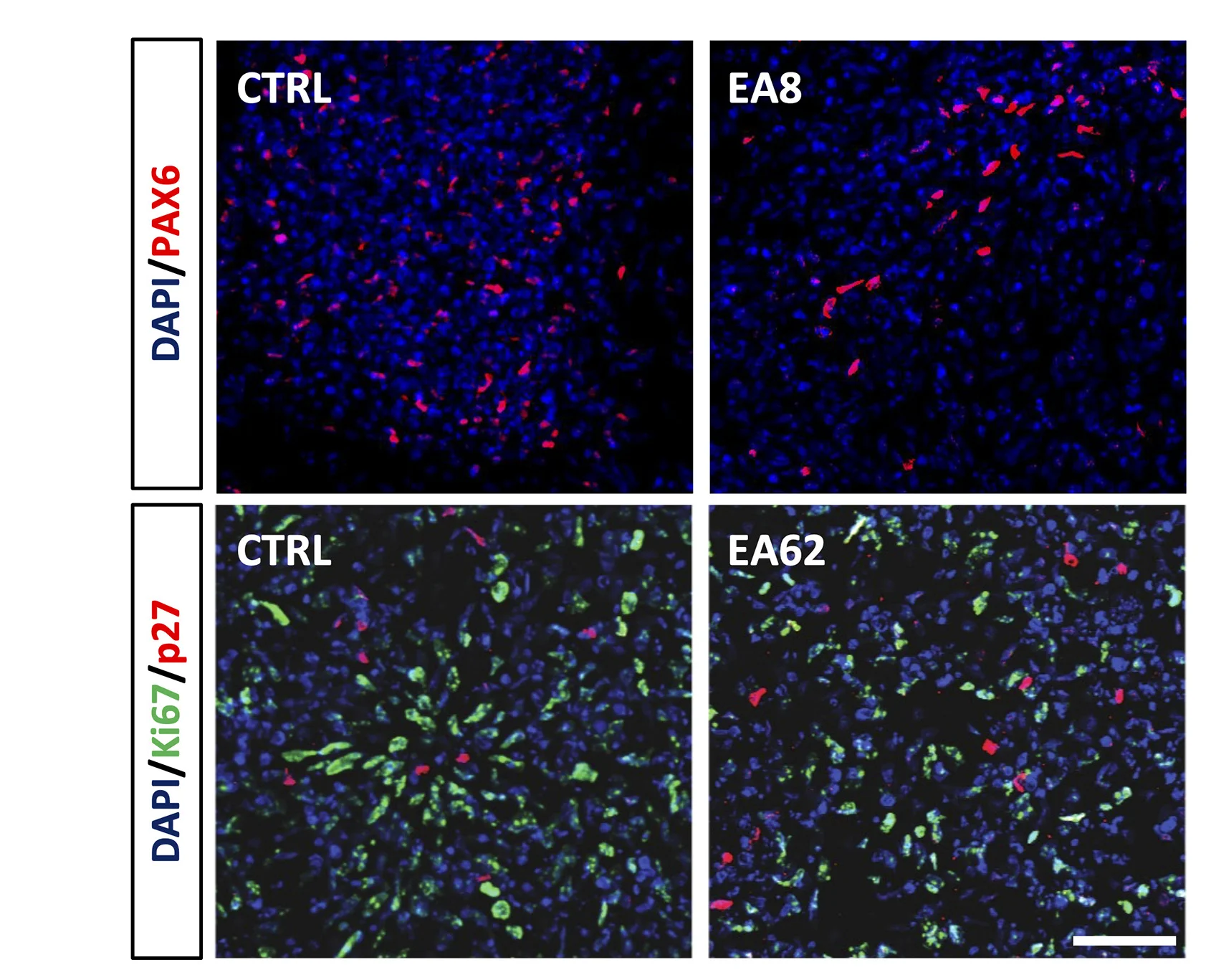 Open access visualization of Microscopy, EA8, EA62, 15q11.2del Lines, Control iPSC Lines