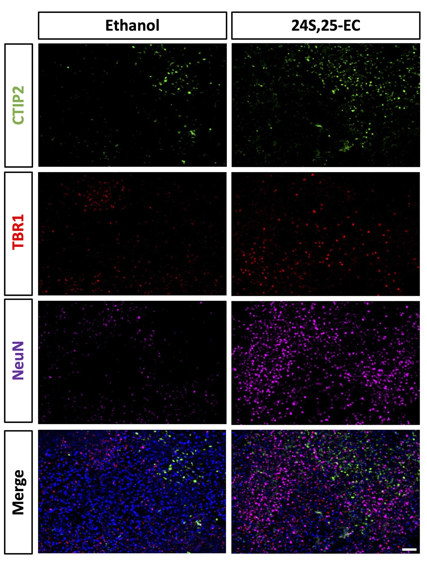 Open access visualization of Microscopy, Immunostaining, TBR1, CTIP2, NeuN