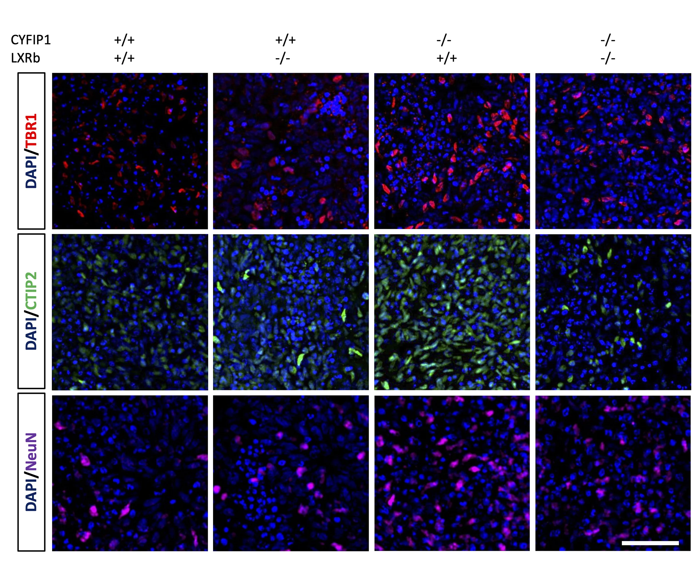 Open access visualization of Microscopy, Neuronal Differentiation, CYFIP1-LoF, NPC, LXRbeta