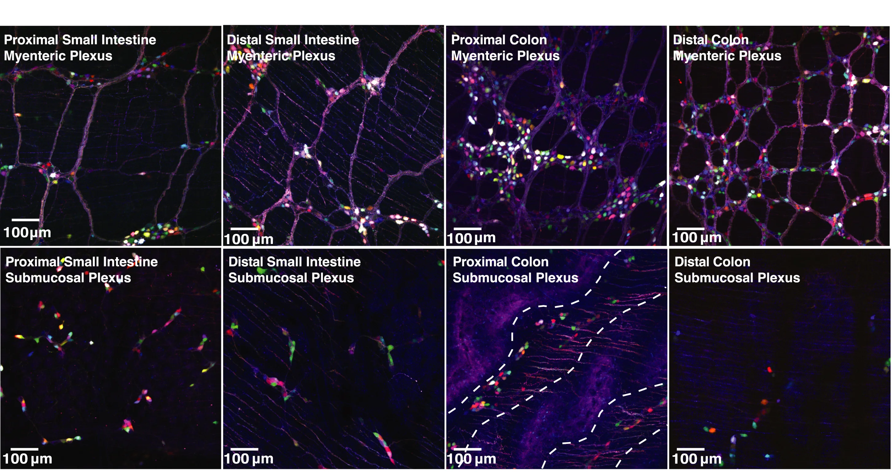 Open access visualization of Microscopy, Small Intestine, Colon, AAV-PHP.S-hSYN1-XFP, Mice