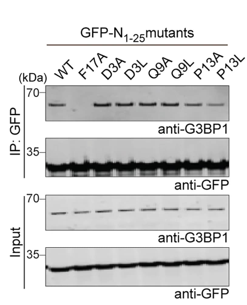 Open access visualization of Gel, HEK293T Cells, Transfection, GFP, Immunoprecipitation