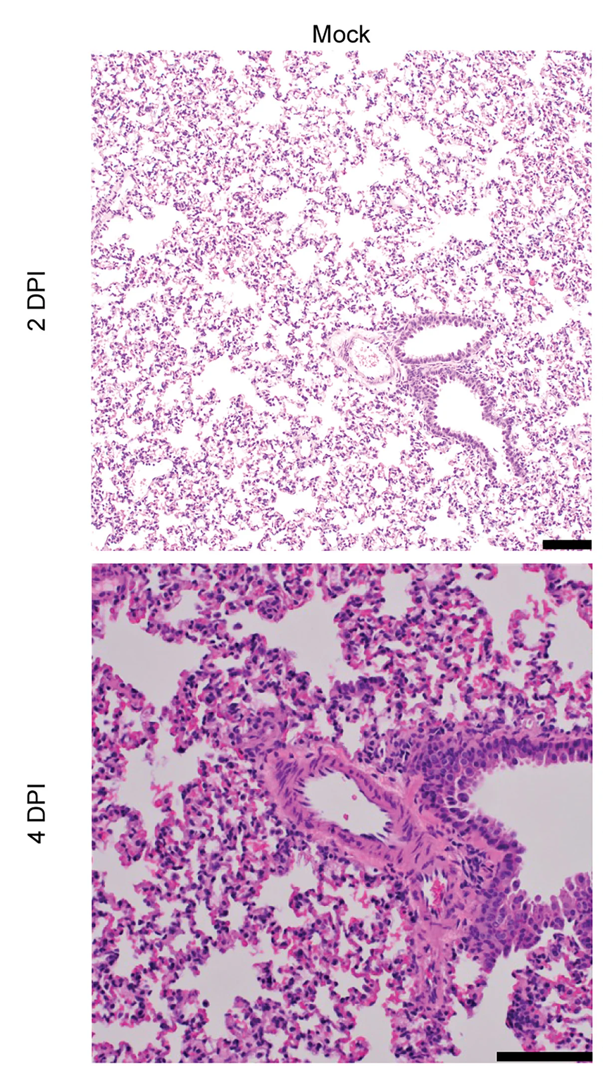 Open access visualization of Microscopy, H&E Staining, Lung Tissue, Scale Bar, Statistical Significance