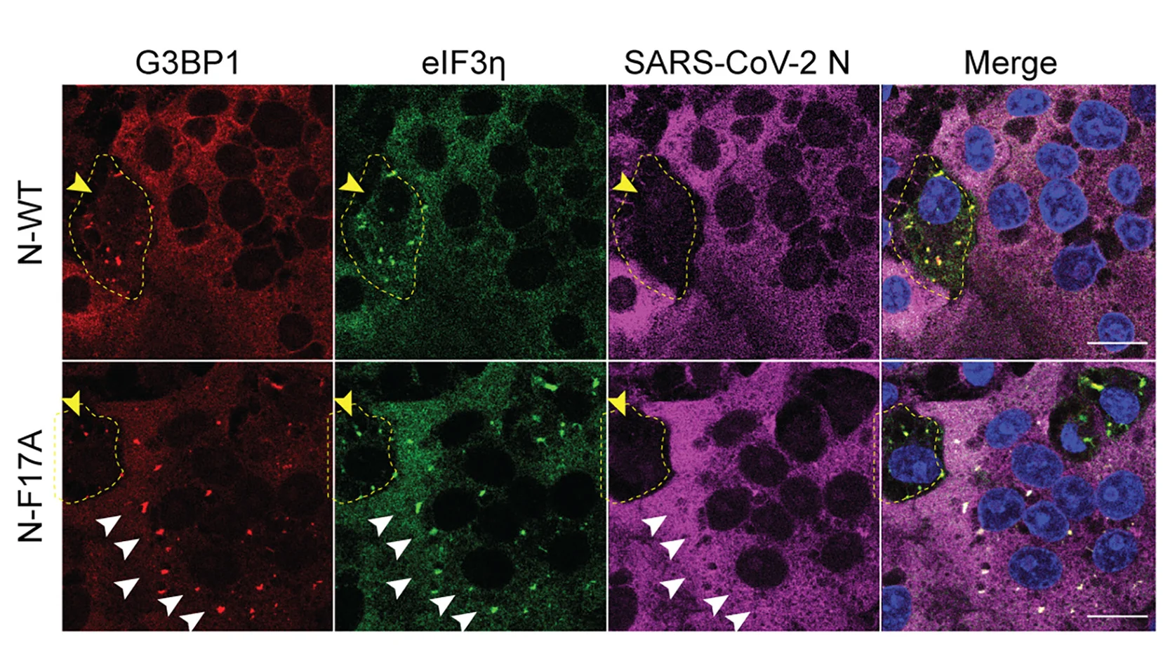 Open access visualization of Microscopy, Vero E6-TMPRSS2 Cells, SARS-CoV-2, N-F17A Mutant, Antibody Staining