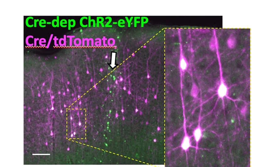 Open access visualization of Microscopy, Cre/tdTomato, ChR2-EYFP, M1 Cortical Region, AAV DIO-ChR2-EYFP Injection