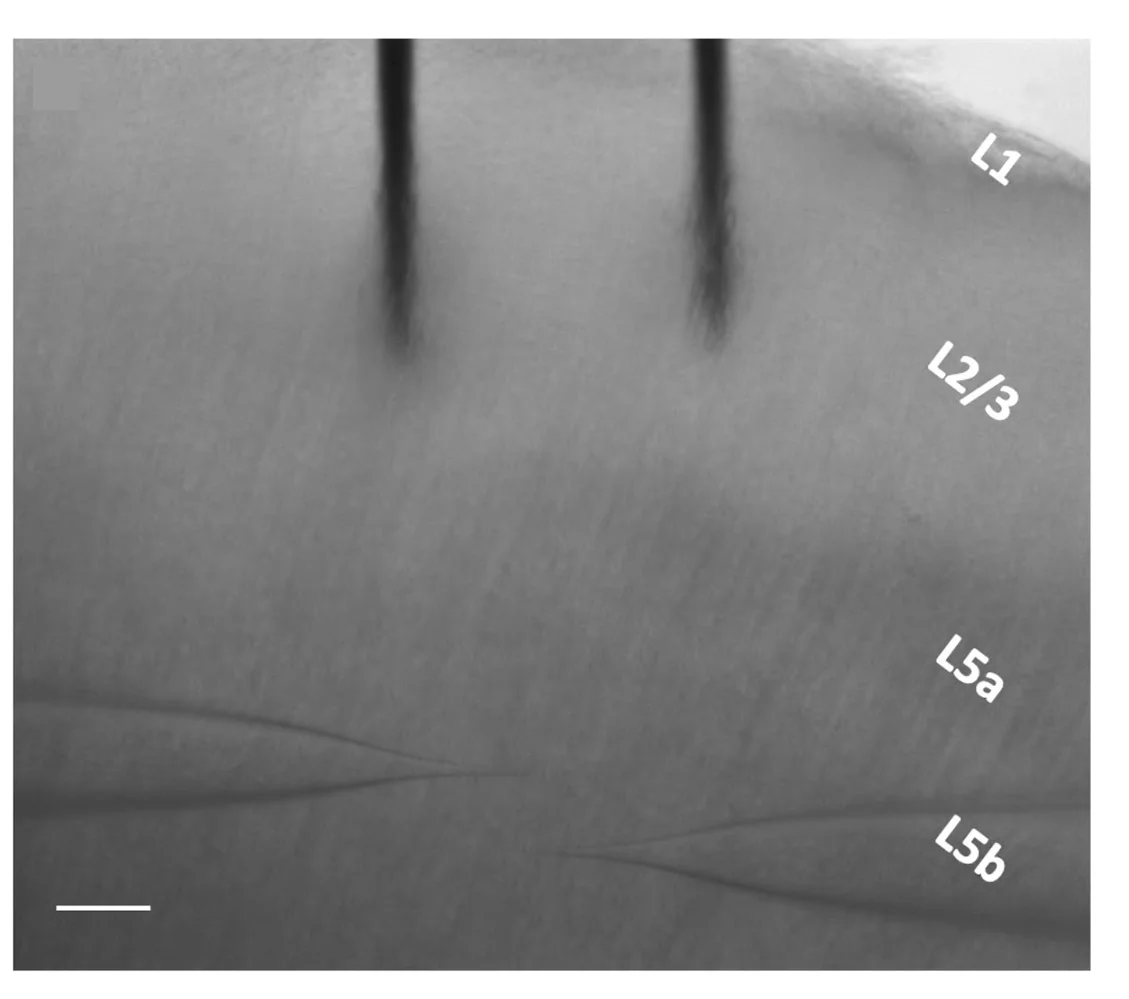Open access visualization of Microscopy, Paired Recordings, Stimulus Electrode, Corticospinal Neurons