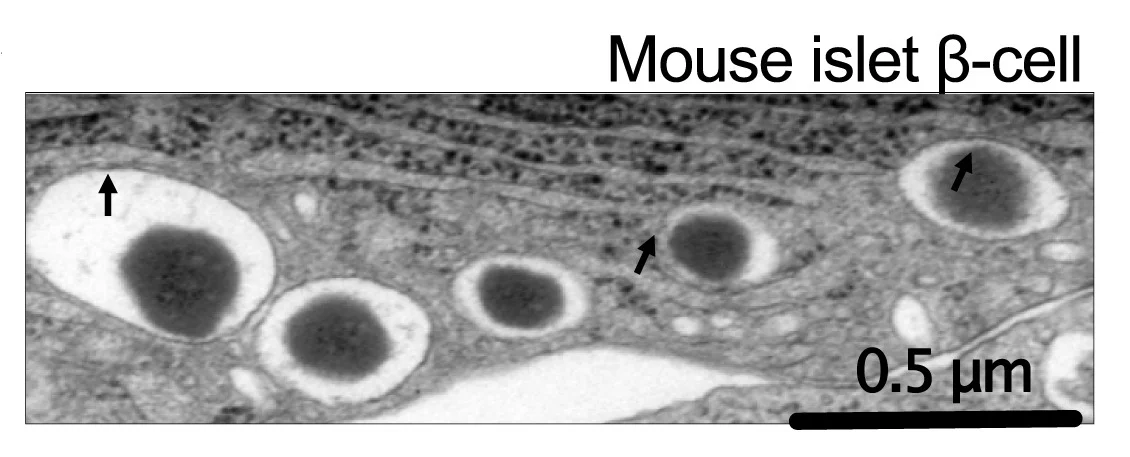 Open access visualization of Microscopy, Transmission Electron Microscopy, Mouse Islet Beta Cell, Insulin Granules, Endoplasmic Reticulum