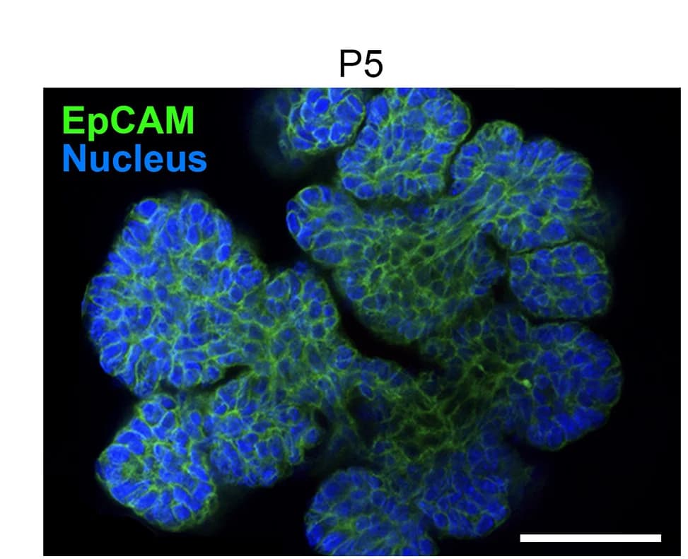 Open access visualization of Microscopy, Immunofluorescence, EpCAM, TEC Organoid, Scale Bar