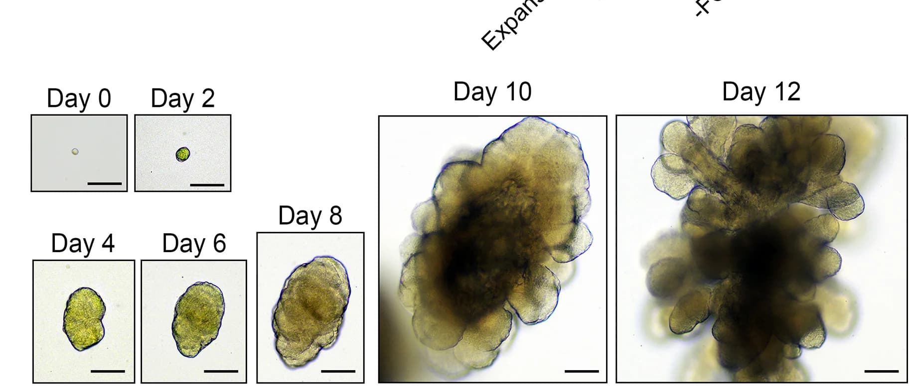 Open access visualization of Microscopy, Clonal Expansion, TEC Organoid, Single Cell, Scale Bar