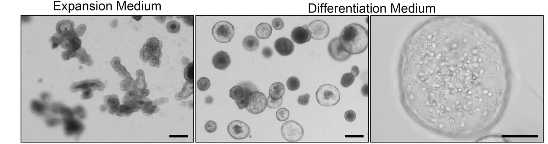 Open access visualization of Microscopy, TEC Organoids, Expansion Medium, Differentiation Medium, Morphology