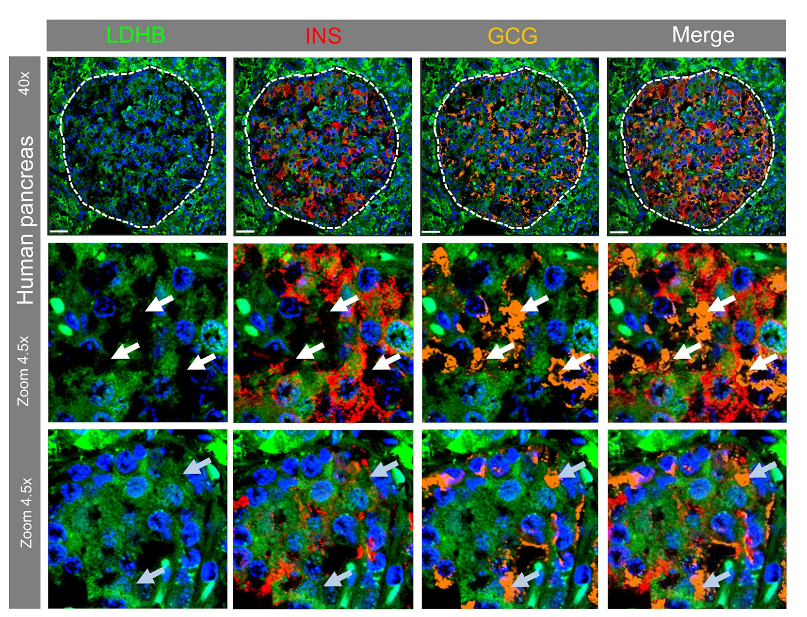 Open access visualization of Microscopy, LDHB Protein Expression, Insulin Expression, Human Pancreas, Glucagon Cells
