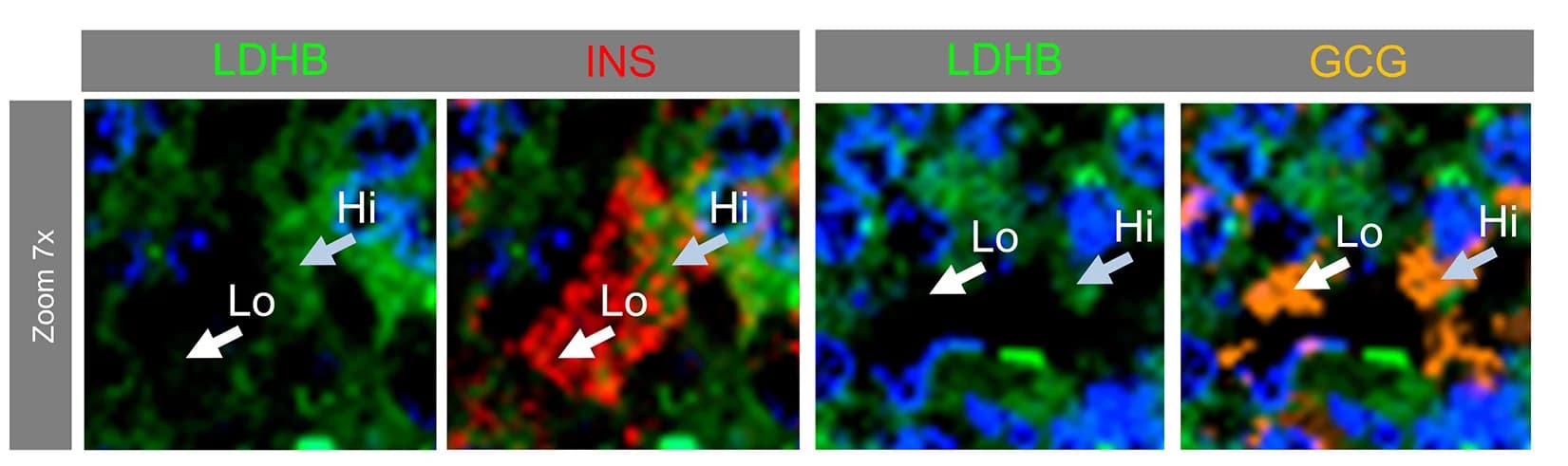 Open access visualization of Microscopy, Representative Images, LDHB High Cells, LDHB Low Cells, GCG