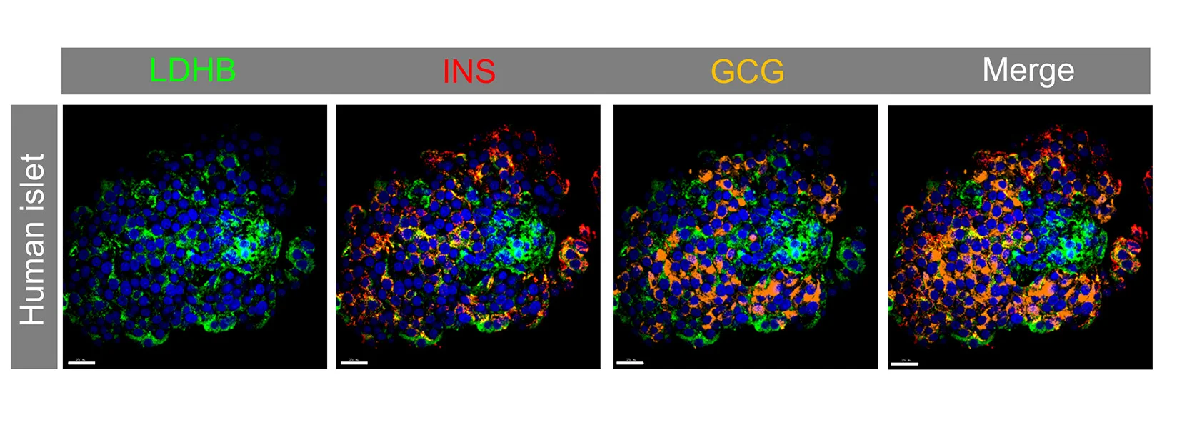 Open access visualization of Microscopy, LDHB Protein Expression, Insulin, Human Islets