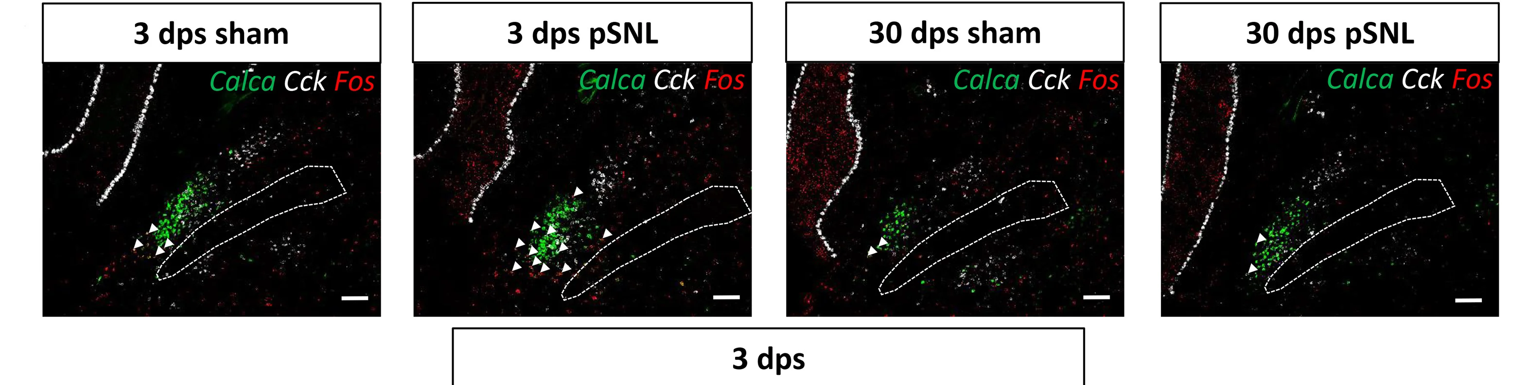 Open access visualization of Microscopy, RNAscope, In Situ Hybridization, Tissue Slices, Sham Surgery